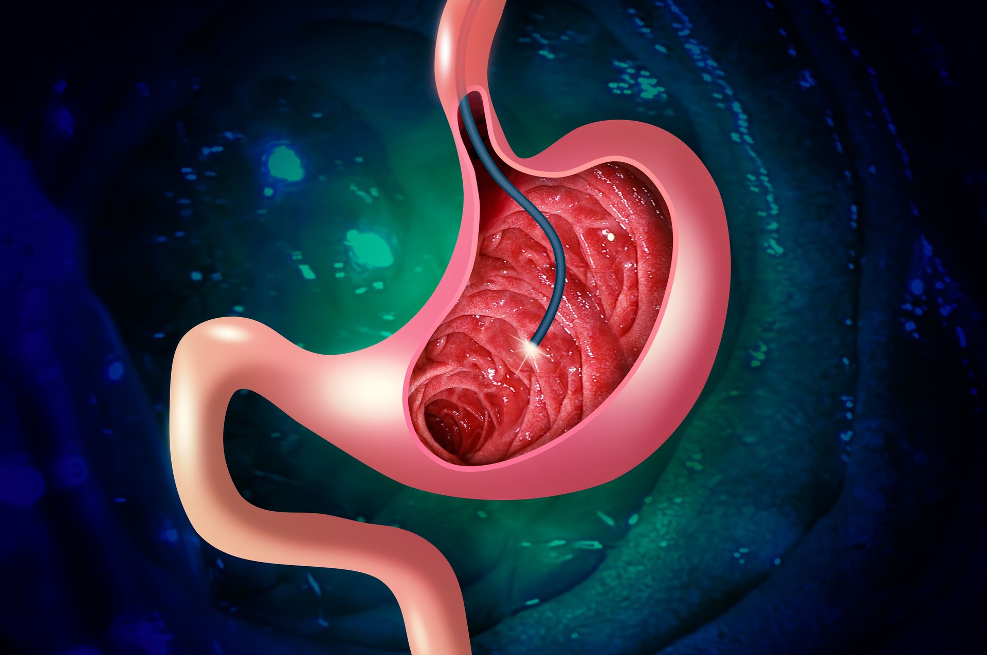 Digestive endoscopy or gastroscopy. Performing a gastroscopy procedure. Diagnostics of gastric diseases. Stomach health.